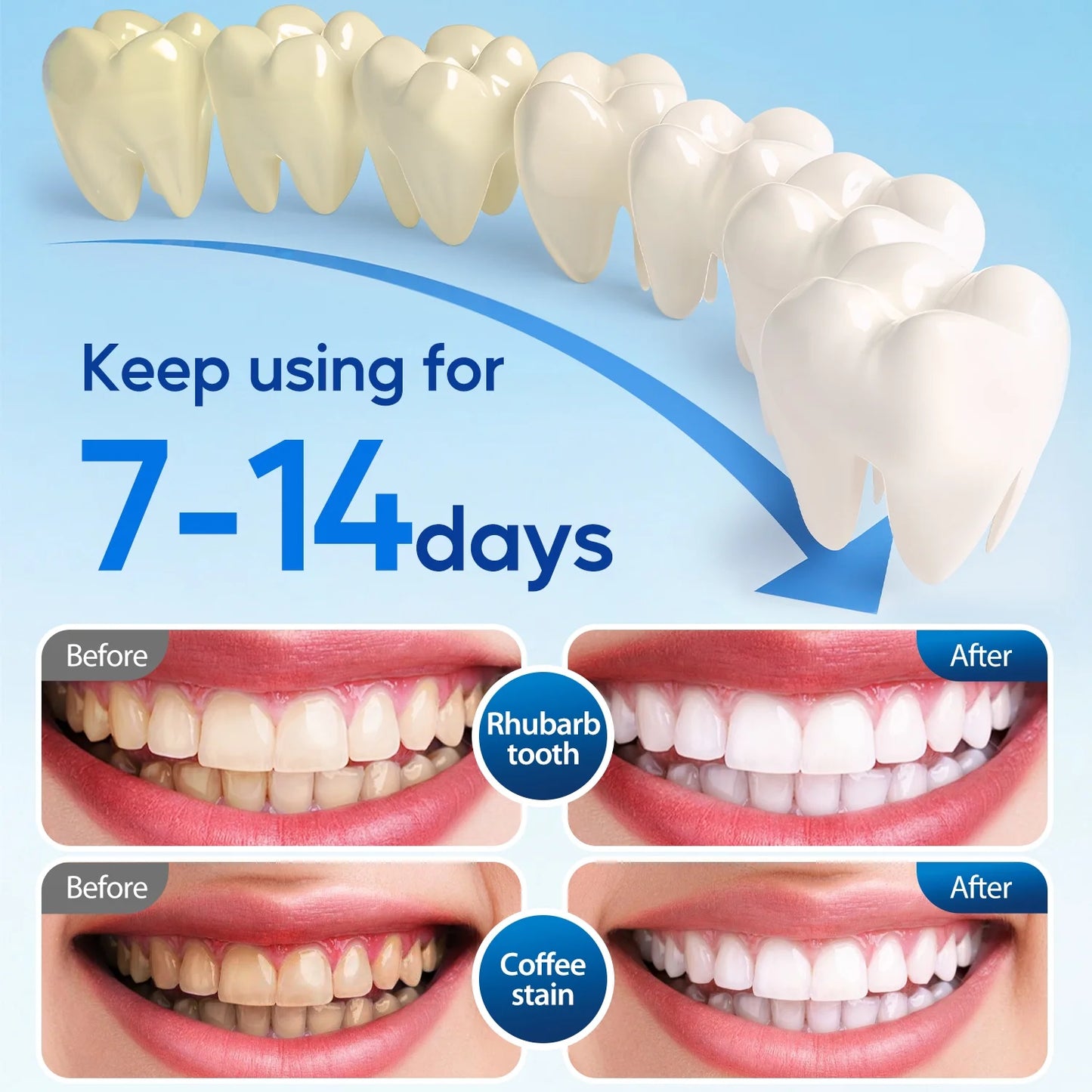 Ultimate LED Teeth Whitening Strips Kit - 28 Strips + 24 Blue Light Accelerator for Fast, Sensitive Care Against Coffee & Smoking Stains!